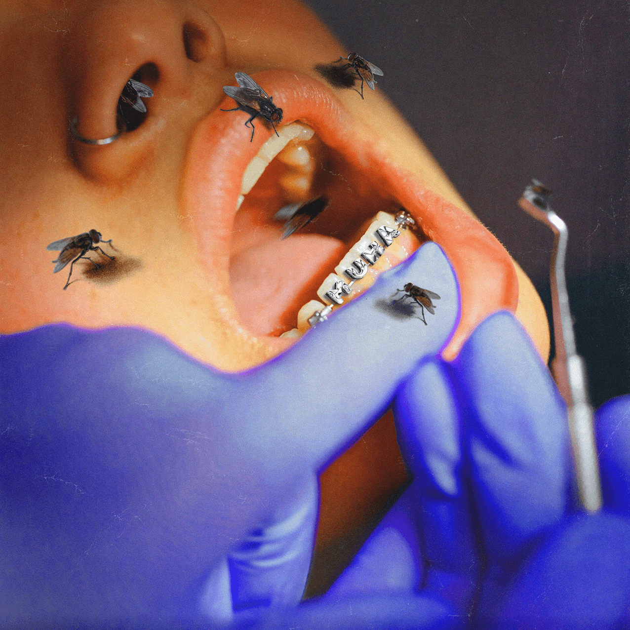 BRACES